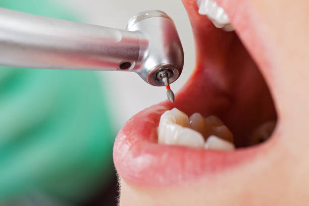 Best Tooth Pain Emergency Relief  in Midway South, TX
